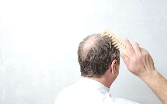 Richtige Pflege bei Haarausfall